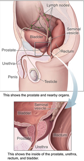 Diagram of Prostate Gland